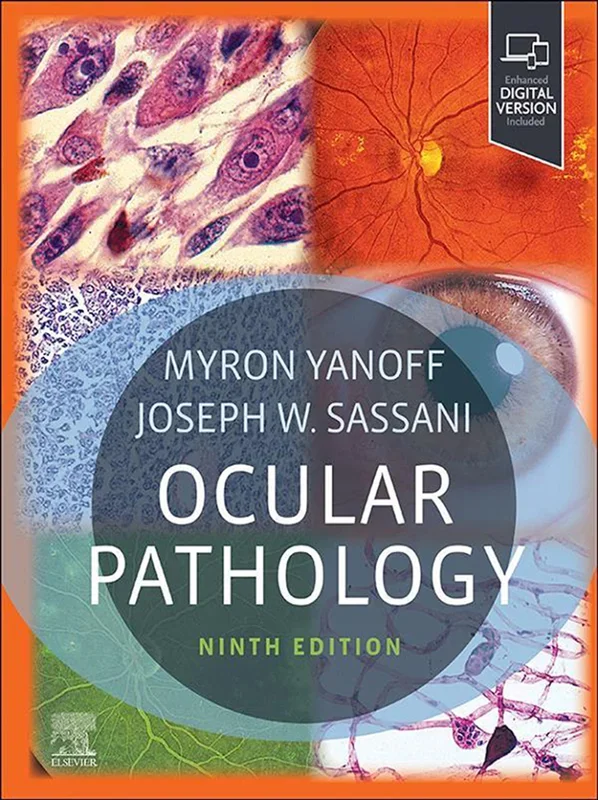 Ocular Pathology 9th Edition